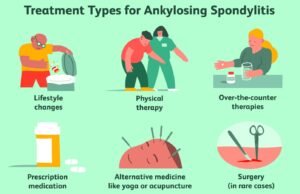 Treatment for ankylosing spondylitis