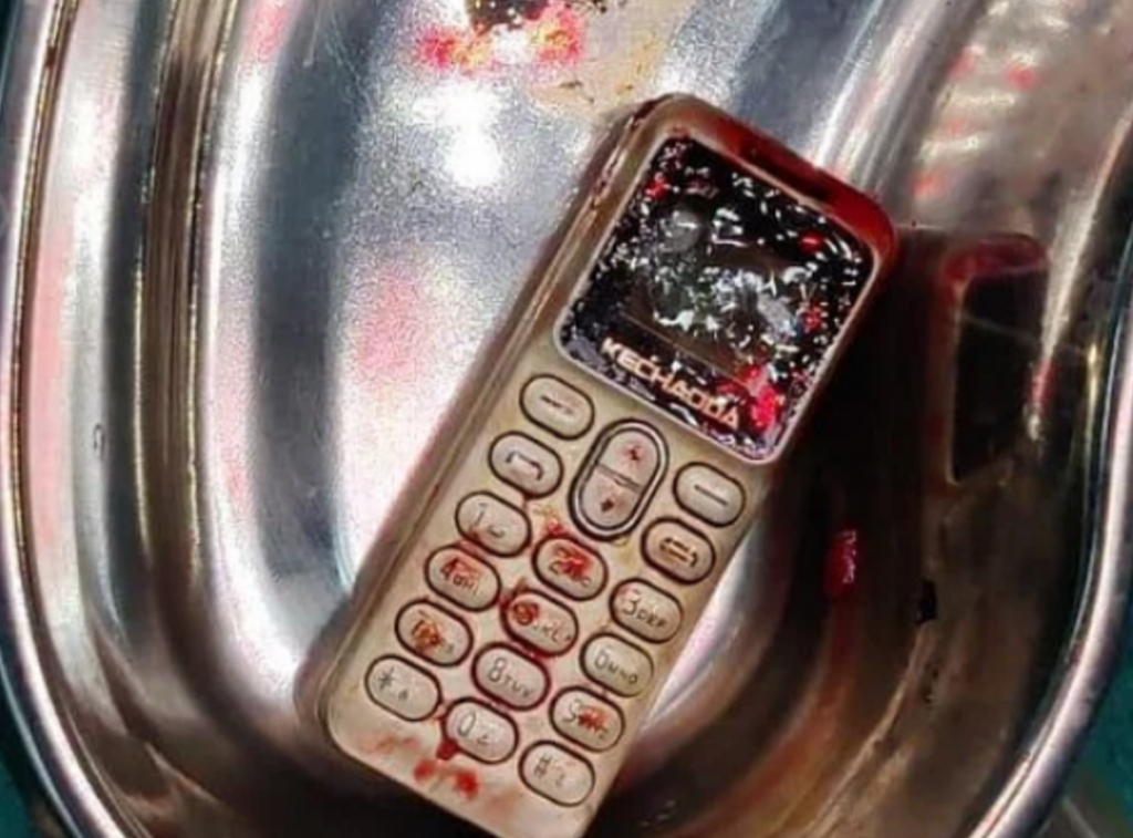 Girl Swallows Mobile To Win Fight With Brother