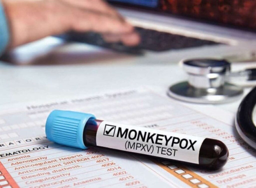 Pakistan on High Alert Officially Confirms First Case of Monkeypox Pakistan on High Alert Officially Confirms First Case of Monkeypox